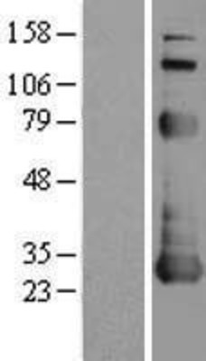 Western Blot: NOL3 Overexpression Lysate (Adult Normal) [NBL1-13710] Left-Empty vector transfected control cell lysate (HEK293 cell lysate); Right -Over-expression Lysate for NOL3.