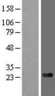 Western Blot: ARMC7 Overexpression Lysate (Adult Normal) [NBL1-07708] Left-Empty vector transfected control cell lysate (HEK293 cell lysate); Right -Over-expression Lysate for ARMC7.