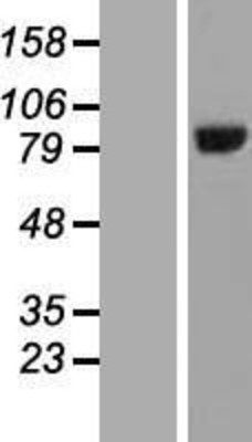 Western Blot: HOOK3 Overexpression Lysate (Adult Normal) [NBL1-11660] Left-Empty vector transfected control cell lysate (HEK293 cell lysate); Right -Over-expression Lysate for HOOK3.