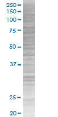 ZNF224 transfected lysate.