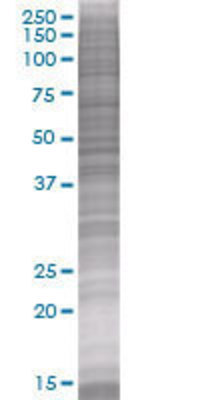 ANKRD1 transfected lysate
