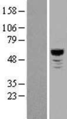 Western Blot: NLK Overexpression Lysate (Adult Normal) [NBL1-13669] Left-Empty vector transfected control cell lysate (HEK293 cell lysate); Right -Over-expression Lysate for NLK.