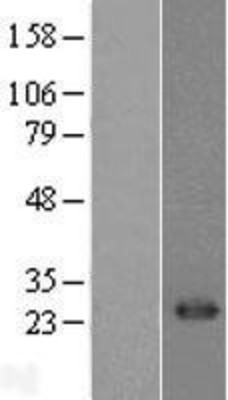 Western Blot: CD8 alpha Overexpression Lysate (Adult Normal) [NBL1-08980] Left-Empty vector transfected control cell lysate (HEK293 cell lysate); Right -Over-expression Lysate for CD8 alpha.