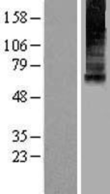 Western Blot: Mucolipin 1 Overexpression Lysate (Adult Normal) [NBL1-12958] Left-Empty vector transfected control cell lysate (HEK293 cell lysate); Right -Over-expression Lysate for Mucolipin 1.