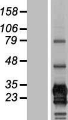 Western Blot: CD79b Overexpression Lysate (Adult Normal) [NBL1-08971] Left-Empty vector transfected control cell lysate (HEK293 cell lysate); Right -Over-expression Lysate for CD79b.