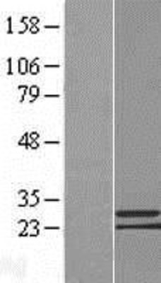 Western Blot: C9orf152 Overexpression Lysate (Adult Normal) [NBL1-08584] Left-Empty vector transfected control cell lysate (HEK293 cell lysate); Right -Over-expression Lysate for C9orf152.