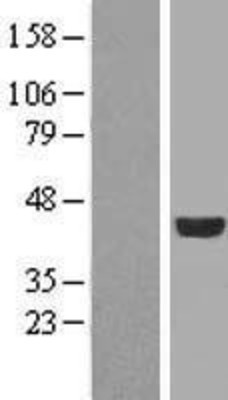 Western Blot: FGFR1OP Overexpression Lysate (Adult Normal) [NBL1-10704] Left-Empty vector transfected control cell lysate (HEK293 cell lysate); Right -Over-expression Lysate for FGFR1OP.