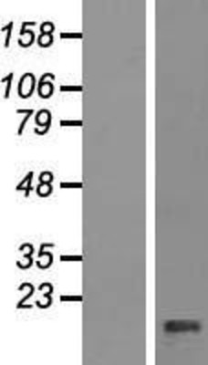 Western Blot: PPP1R11 Overexpression Lysate (Adult Normal) [NBP2-06494] Left-Empty vector transfected control cell lysate (HEK293 cell lysate); Right -Over-expression Lysate for PPP1R11.