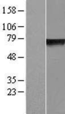 Western Blot: GLB1L Overexpression Lysate (Adult Normal) [NBP2-06325] Left-Empty vector transfected control cell lysate (HEK293 cell lysate); Right -Over-expression Lysate for GLB1L.