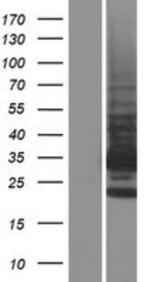 Western Blot: TMBIM1 Overexpression Lysate (Adult Normal) [NBP2-06458] Left-Empty vector transfected control cell lysate (HEK293 cell lysate); Right -Over-expression Lysate for TMBIM1.