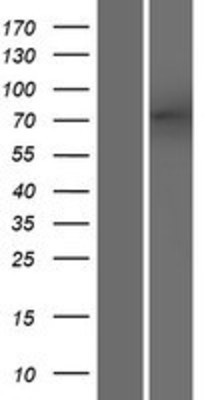 Western Blot: ODF2L Overexpression Lysate (Adult Normal) [NBP2-06617] Left-Empty vector transfected control cell lysate (HEK293 cell lysate); Right -Over-expression Lysate for ODF2L.