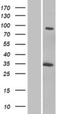 Western Blot: GCC1 Overexpression Lysate (Adult Normal) [NBP2-06329] Left-Empty vector transfected control cell lysate (HEK293 cell lysate); Right -Over-expression Lysate for GCC1.