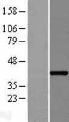 Western Blot: OSGEPL1 Overexpression Lysate (Adult Normal) [NBP2-06439] Left-Empty vector transfected control cell lysate (HEK293 cell lysate); Right -Over-expression Lysate for OSGEPL1.