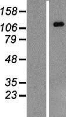 Western Blot: CARD12 Overexpression Lysate (Adult Normal) [NBP2-06545] Left-Empty vector transfected control cell lysate (HEK293 cell lysate); Right -Over-expression Lysate for CARD12.
