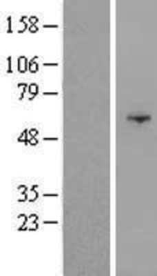 Western Blot: OSBPL9 Overexpression Lysate (Adult Normal) [NBL1-13996] Left-Empty vector transfected control cell lysate (HEK293 cell lysate); Right -Over-expression Lysate for OSBPL9.