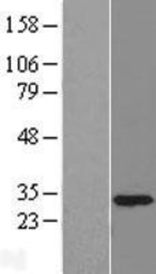 Western Blot: U11/U12-35K Overexpression Lysate (Adult Normal) [NBL1-17489] Left-Empty vector transfected control cell lysate (HEK293 cell lysate); Right -Over-expression Lysate for U11/U12-35K.