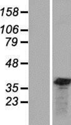 Western Blot: GEMIN8 Overexpression Lysate (Adult Normal) [NBP2-09233] Left-Empty vector transfected control cell lysate (HEK293 cell lysate); Right -Over-expression Lysate for GEMIN8.