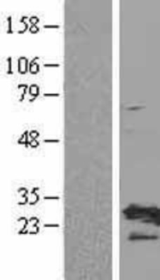 Western Blot: RPL19 Overexpression Lysate (Adult Normal) [NBL1-15513] Left-Empty vector transfected control cell lysate (HEK293 cell lysate); Right -Over-expression Lysate for RPL19.
