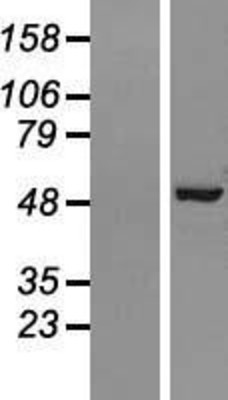 Western Blot: AP2M1 Overexpression Lysate (Adult Normal) [NBL1-07580] Left-Empty vector transfected control cell lysate (HEK293 cell lysate); Right -Over-expression Lysate for AP2M1.