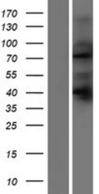 Western Blot: SORBS2 Overexpression Lysate (Adult Normal) [NBP2-06568] Left-Empty vector transfected control cell lysate (HEK293 cell lysate); Right -Over-expression Lysate for SORBS2.