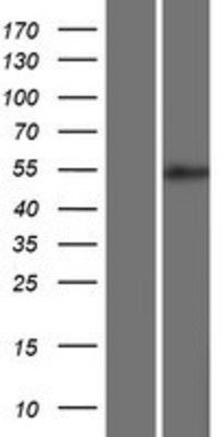 Western Blot: BRUNOL5 Overexpression Lysate (Adult Normal) [NBP2-06501] Left-Empty vector transfected control cell lysate (HEK293 cell lysate); Right -Over-expression Lysate for BRUNOL5.