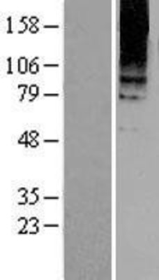 Western Blot: metabotropic Glutamate Receptor 8 Overexpression Lysate (Adult Normal) [NBL1-11352] Left-Empty vector transfected control cell lysate (HEK293 cell lysate); Right -Over-expression Lysate for metabotropic Glutamate Receptor 8.