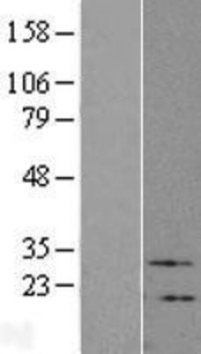 Western Blot: VIP Overexpression Lysate (Adult Normal) [NBL1-17723] Left-Empty vector transfected control cell lysate (HEK293 cell lysate); Right -Over-expression Lysate for VIP.