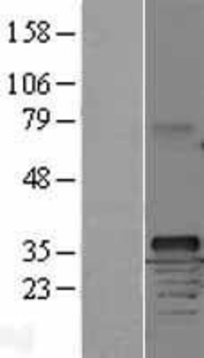 Western Blot: Cyclin D1 Overexpression Lysate (Adult Normal) [NBL1-08871] Left-Empty vector transfected control cell lysate (HEK293 cell lysate); Right -Over-expression Lysate for Cyclin D1.