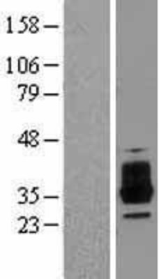 Western Blot: OSCAR Overexpression Lysate (Adult Normal) [NBL1-13997] Left-Empty vector transfected control cell lysate (HEK293 cell lysate); Right -Over-expression Lysate for OSCAR.