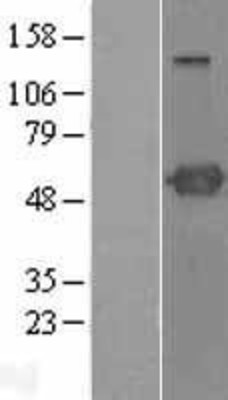 Western Blot: PSTPIP1 Overexpression Lysate (Adult Normal) [NBL1-14915] Left-Empty vector transfected control cell lysate (HEK293 cell lysate); Right -Over-expression Lysate for PSTPIP1.