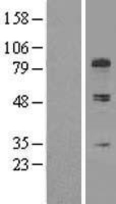 Western Blot: COL13A1 Overexpression Lysate (Adult Normal) [NBP2-09507] Left-Empty vector transfected control cell lysate (HEK293 cell lysate); Right -Over-expression Lysate for COL13A1.