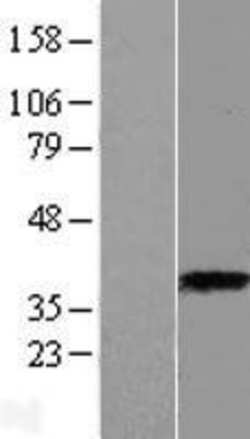 Western Blot: ASPA Overexpression Lysate (Adult Normal) [NBP2-09465] Left-Empty vector transfected control cell lysate (HEK293 cell lysate); Right -Over-expression Lysate for ASPA.