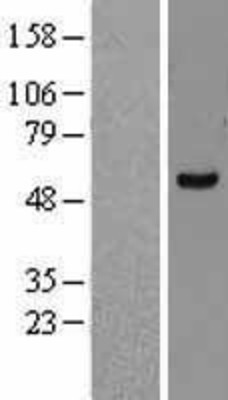 Western Blot: FASTK Overexpression Lysate (Adult Normal) [NBL1-10602] Left-Empty vector transfected control cell lysate (HEK293 cell lysate); Right -Over-expression Lysate for FASTK.