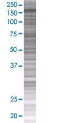 MAP3K5 transfected lysate.