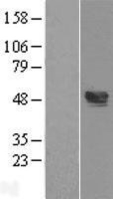 Western Blot: TXNIP Overexpression Lysate (Adult Normal) [NBL1-17474] Left-Empty vector transfected control cell lysate (HEK293 cell lysate); Right -Over-expression Lysate for TXNIP.