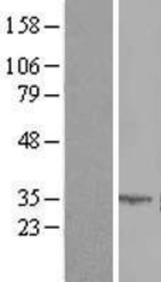Western Blot: SLC25A6 Overexpression Lysate (Adult Normal) [NBL1-16074] Left-Empty vector transfected control cell lysate (HEK293 cell lysate); Right -Over-expression Lysate for SLC25A6.