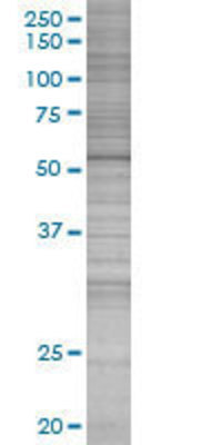 STK11 transfected lysate.