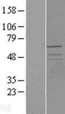 Western Blot: PCTAIRE2 Overexpression Lysate (Adult Normal) [NBL1-14195] Left-Empty vector transfected control cell lysate (HEK293 cell lysate); Right -Over-expression Lysate for PCTAIRE2.