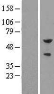 Western Blot: Pea3 Overexpression Lysate (Adult Normal) [NBL1-10360] Left-Empty vector transfected control cell lysate (HEK293 cell lysate); Right -Over-expression Lysate for Pea3.