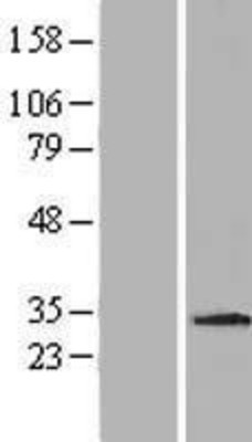 Western Blot: MDM1 Overexpression Lysate (Adult Normal) [NBP2-06693] Left-Empty vector transfected control cell lysate (HEK293 cell lysate); Right -Over-expression Lysate for MDM1.
