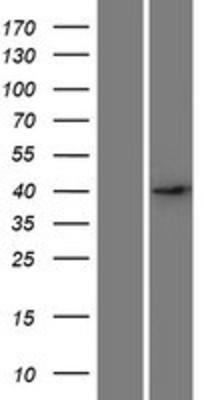Western Blot: DSN1 Overexpression Lysate (Adult Normal) [NBP2-09738] Left-Empty vector transfected control cell lysate (HEK293 cell lysate); Right -Over-expression Lysate for DSN1.