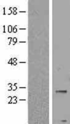 Western Blot: PNPLA4 Overexpression Lysate (Adult Normal) [NBP2-09636] Left-Empty vector transfected control cell lysate (HEK293 cell lysate); Right -Over-expression Lysate for PNPLA4.