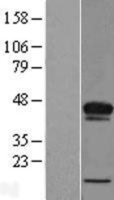 Western Blot: ACBD4 Overexpression Lysate (Adult Normal) [NBP2-09577] Left-Empty vector transfected control cell lysate (HEK293 cell lysate); Right -Over-expression Lysate for ACBD4.