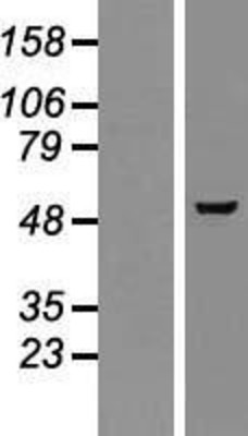 Western Blot: GMEB2 Overexpression Lysate (Adult Normal) [NBP2-07457] Left-Empty vector transfected control cell lysate (HEK293 cell lysate); Right -Over-expression Lysate for GMEB2.