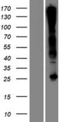 Western Blot: C17orf77 Overexpression Lysate (Adult Normal) [NBP2-05361] Left-Empty vector transfected control cell lysate (HEK293 cell lysate); Right -Over-expression Lysate for C17orf77.