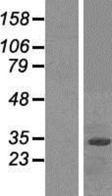 Western Blot: FBXO2 Overexpression Lysate (Adult Normal) [NBP2-07485] Left-Empty vector transfected control cell lysate (HEK293 cell lysate); Right -Over-expression Lysate for FBXO2.