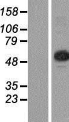 Western Blot: CGI-09 Overexpression Lysate (Adult Normal) [NBP2-07108] Left-Empty vector transfected control cell lysate (HEK293 cell lysate); Right -Over-expression Lysate for CGI-09.