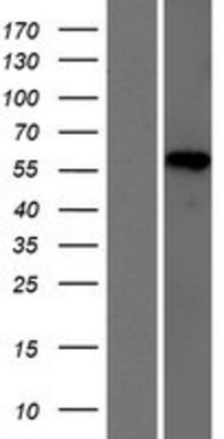 Western Blot: HP1BP3 Overexpression Lysate (Adult Normal) [NBP2-07058] Left-Empty vector transfected control cell lysate (HEK293 cell lysate); Right -Over-expression Lysate for HP1BP3.