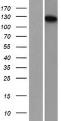 Western Blot: TDRD7 Overexpression Lysate (Adult Normal) [NBP2-07357] Left-Empty vector transfected control cell lysate (HEK293 cell lysate); Right -Over-expression Lysate for TDRD7.