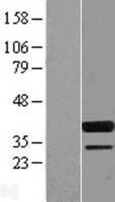 Western Blot: SPIB Overexpression Lysate (Adult Normal) [NBL1-16399] Left-Empty vector transfected control cell lysate (HEK293 cell lysate); Right -Over-expression Lysate for SPIB.